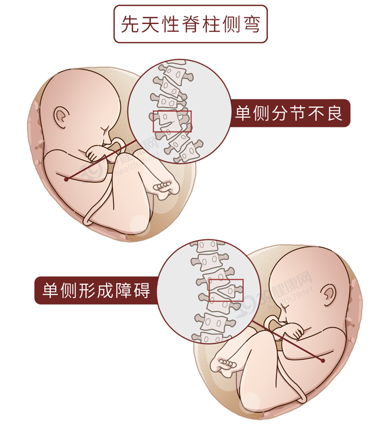 孕中期正确的坐姿图片图片